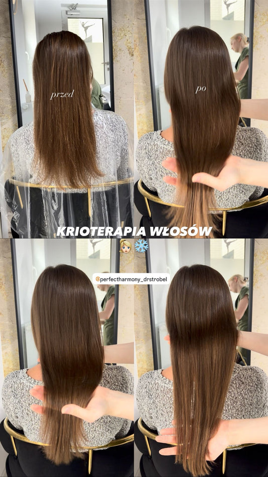 Krioterapia włosów – na czym polega zabieg i jakie daje efekty?